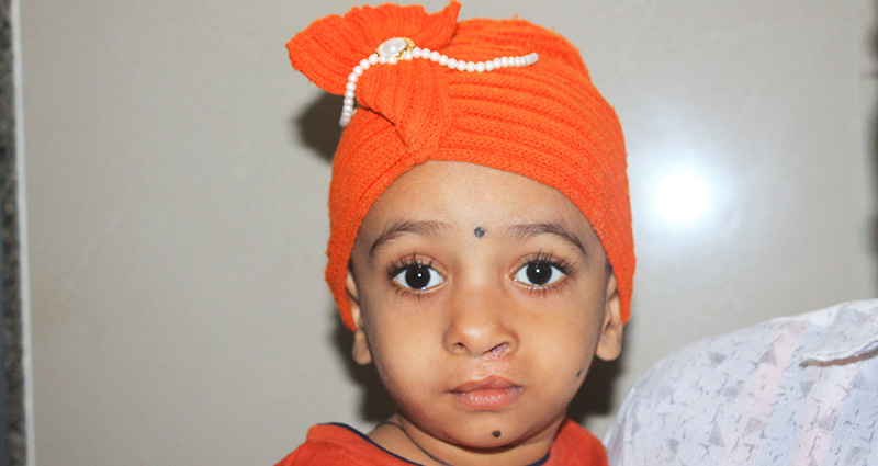 Care for Persons with Facial Cleft/Cleft Palate